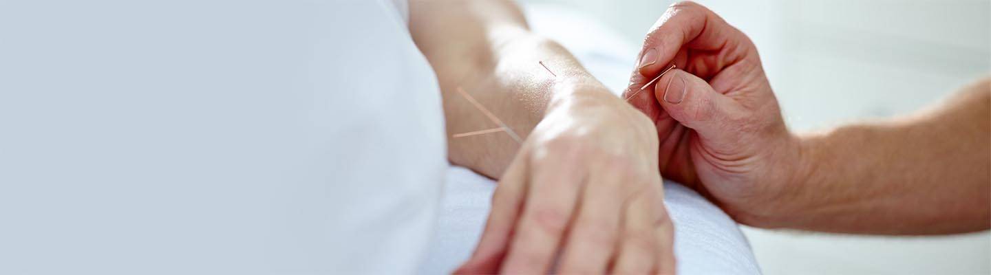 acupunturista aplica una aguja en la muñeca del paciente